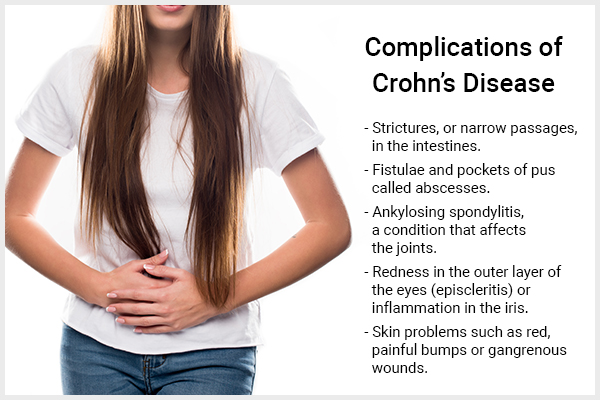 complications associated with crohn's disease
