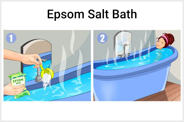 taking an Epsom salt bath can help provide relief from genital herpes discomfort