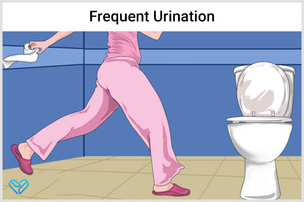 an urge to urinate frequently can be a sign of poorly managed diabetes
