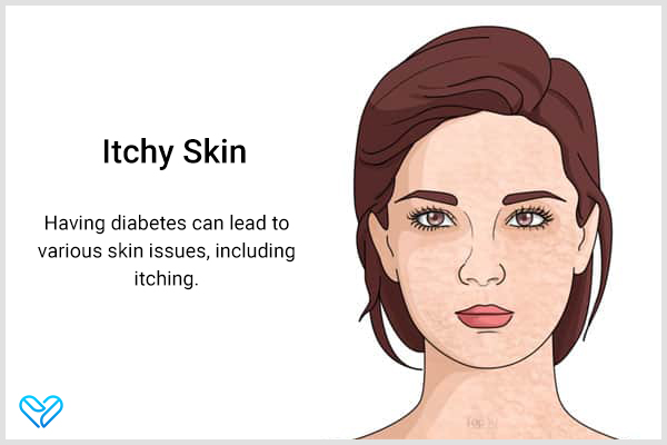 having diabetes can lead to various skin issues including itching