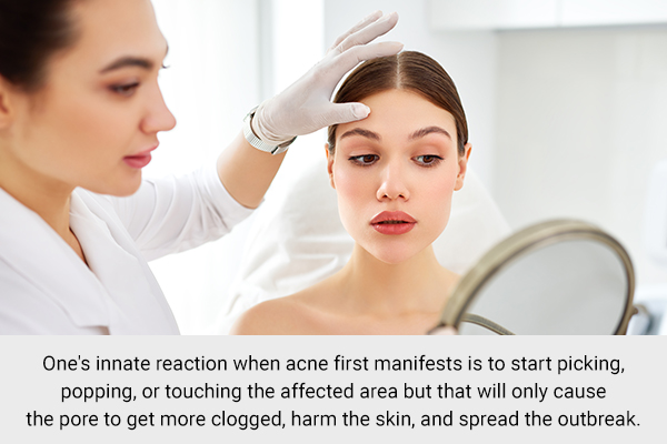 keep your hands away from your face when suffering from acne