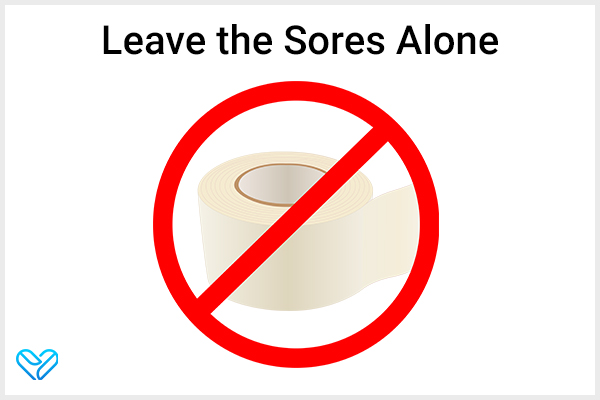 leave the genital herpes sore alone, do not scratch or pick at it