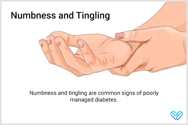 numbness and tingling are common signs of poorly managed diabetes