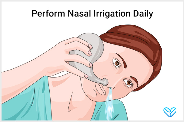 perform nasal irrigation daily to deal with sinus infections