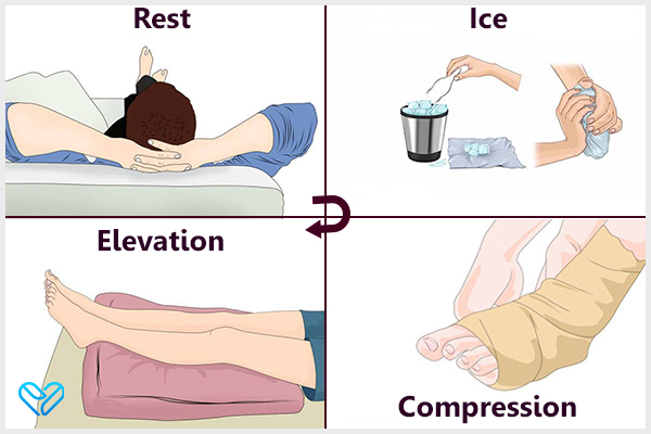 perform RICE therapy to soothe discomfort of leg cramps