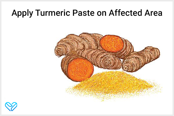 rub turmeric paste on the affected area to relieve leg cramps