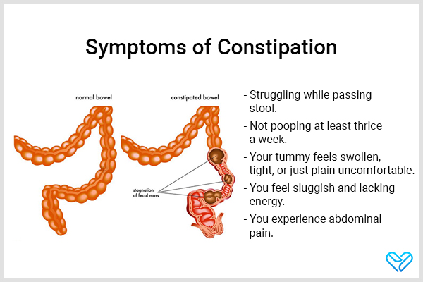 signs and symptoms of constipation