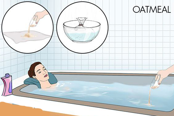 taking an oatmeal bath can help manage postpartum hives