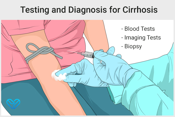 testing and diagnosis for liver cirrhosis