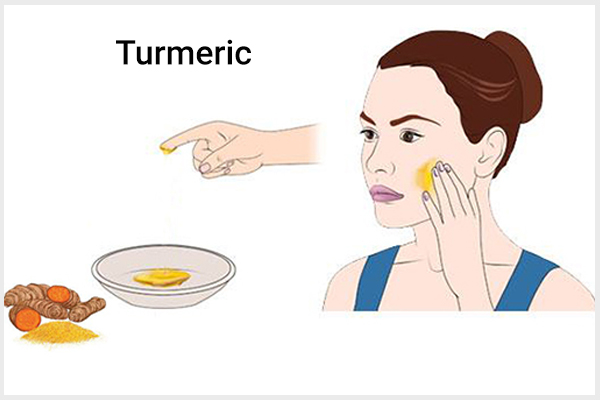 using turmeric topically can help prevent flat warts