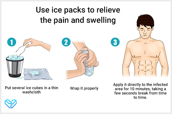 using ice packs can help relieve the swelling and pain from genital herpes