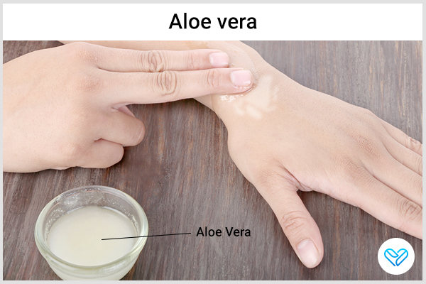 applying aloe vera on the ganglion cysts can help get rid of them