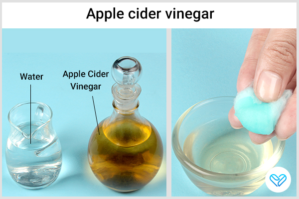 try using apple cider vinegar for relieving ganglion cysts