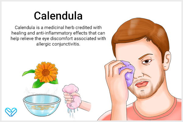 calendula for allergic conjunctivitis