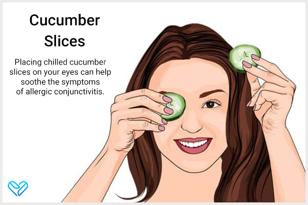 apply cucumber slice for allergic conjunctivitis