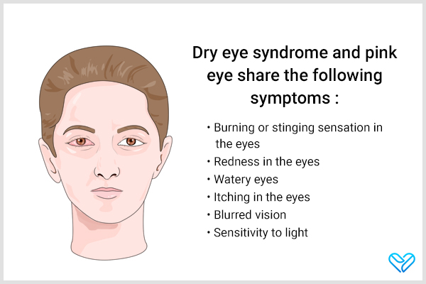 dry eye syndrome can be mistaken for pink eye as both have similar symptoms