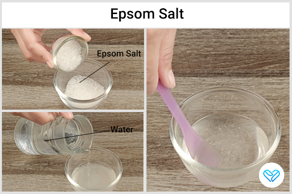 use an Epsom salt soak to help get rid of ganglion cysts