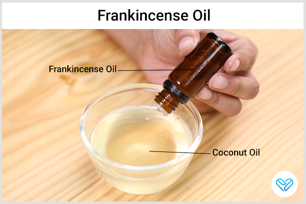 use frankincense oil to help manage ganglion cysts