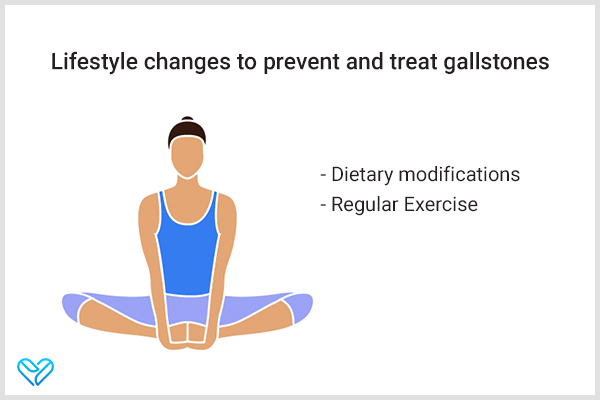 lifestyle changes to treat and prevent gallstones