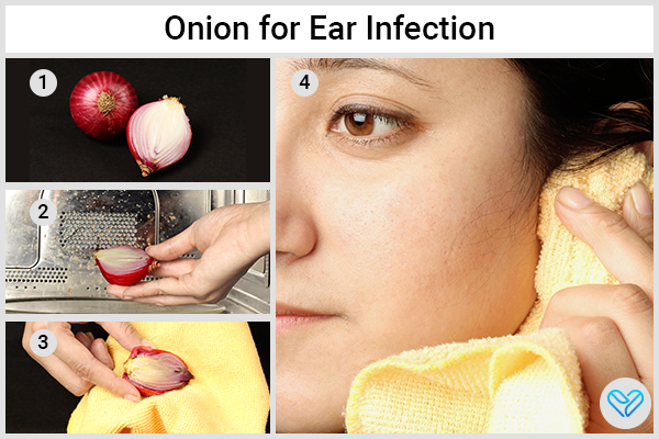 onions can also work wonders in reducing severity of ear infections