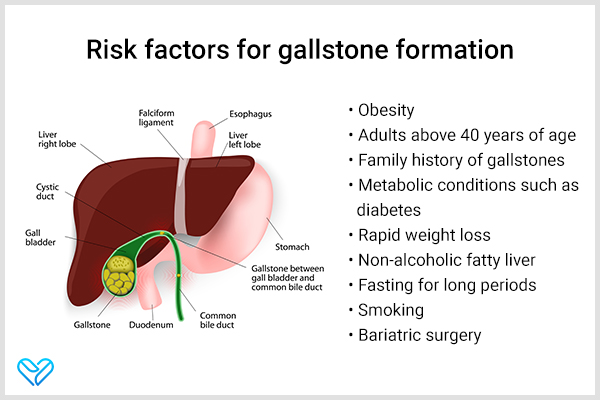 risk factors responsible for gallstone formation