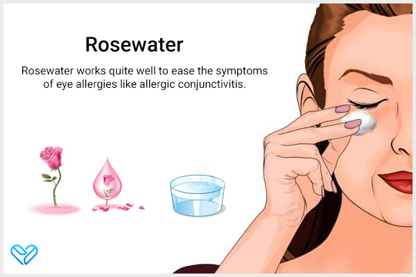 rosewater for allergic conjunctivitis