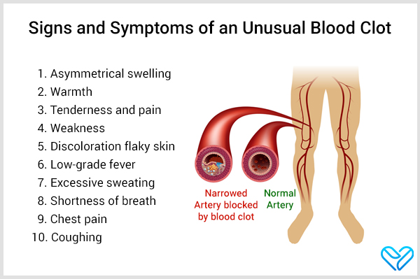 10 Signs And Symptoms Of An Unusual Blood Clot Emedihealth
