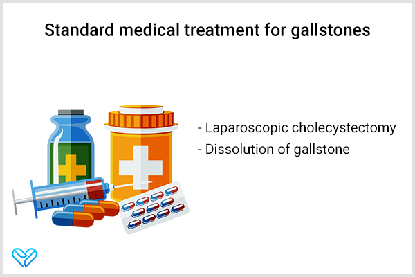 standard treatment for gallstones