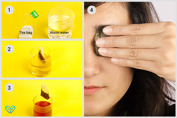 try using tea bags to soothe discomfort of eye infections