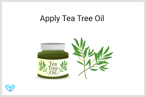tea tree oil can help treat keloid scars