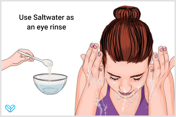 use saltwater as an eye rinse to help alleviate eye infections