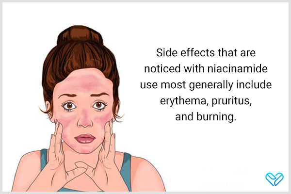 side effects of using niacinamide on skin