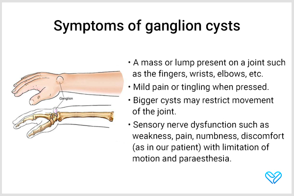 signs and symptoms indicative of ganglion cysts