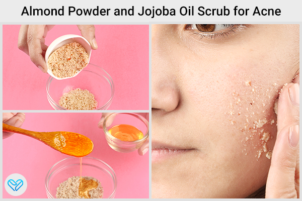 almond-jojoba oil scrub for acne-prone skin