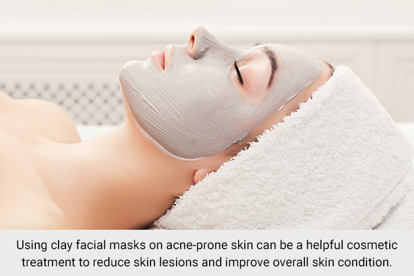 face masks suitable for acne-prone skin