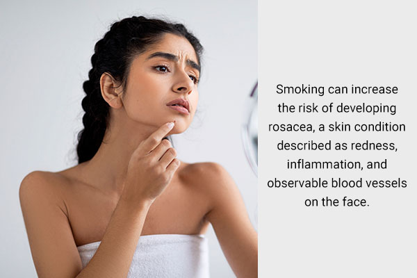 quitting smoking can help reduce risk of rosacea