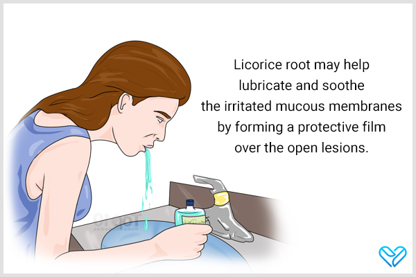 licorice root mouthwash can help relieve mouth ulcers