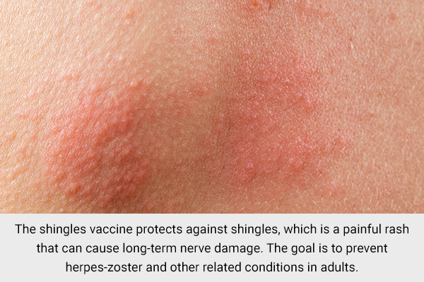 vaccination against shingles