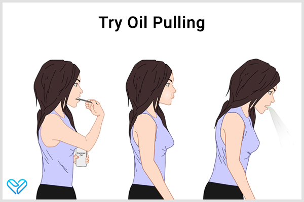 try oil pulling to remove plaque and tartar buildup