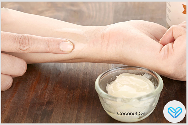 use coconut oil to the allergy-prone areas