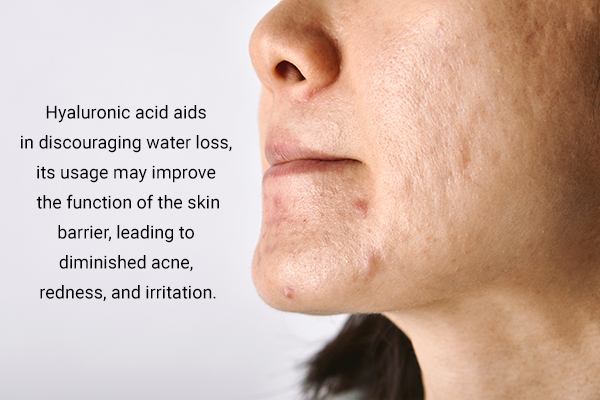 hyaluronic acid helps enhance the skin's barrier function
