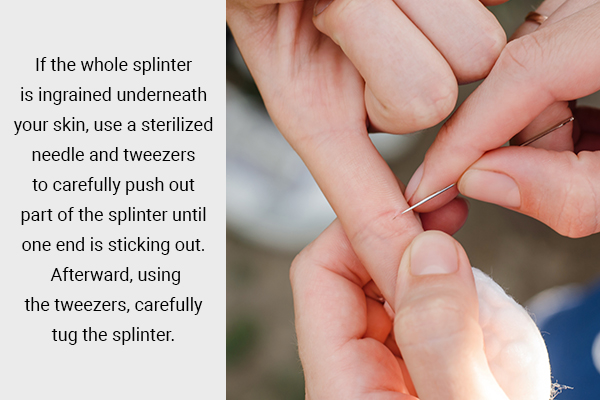 if the whole splinter is ingrained underneath skin, try using a small needle