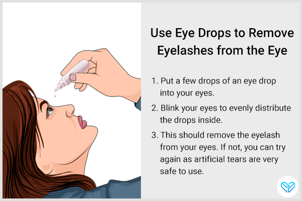 put eye drops to remove stuck eyelashes from the eye