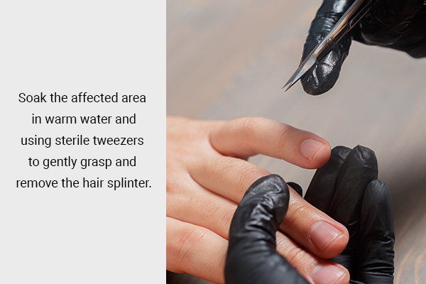 what experts have to say regarding removing a hair splinter