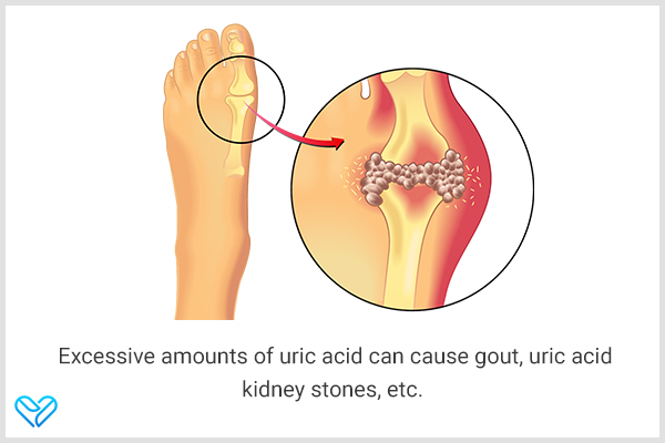 reasons why it is important to lower uric acid levels in the body