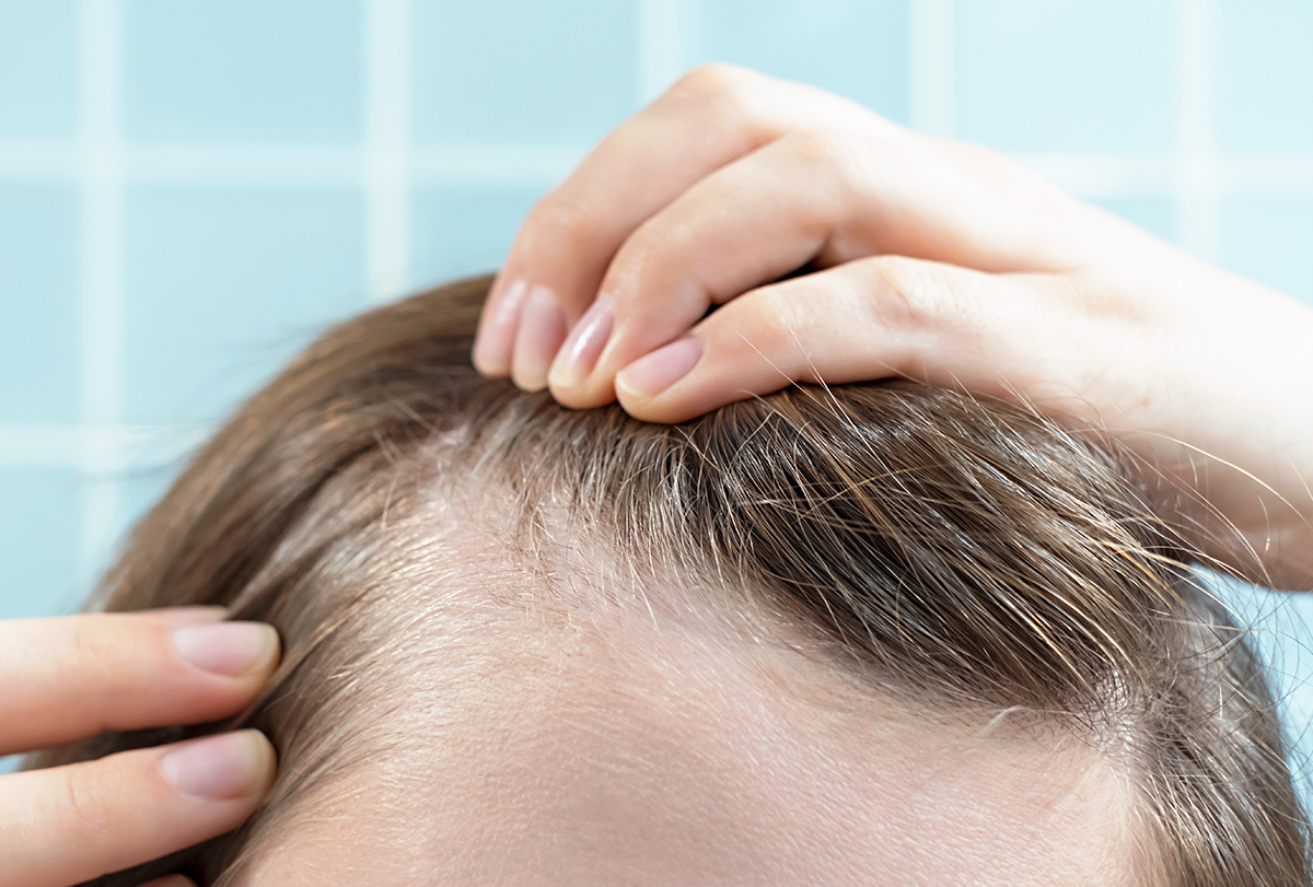 what is better for hair thinning: biotin or collagen